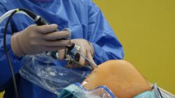 Dokter bedah menggunakan artroskop untuk operasi lutut yang presisi di ruang operasi.